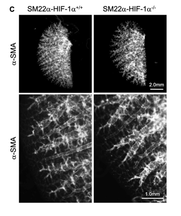 3-D images of -SMA-stained vasculature from adult SM22-HIF-1 mice. 